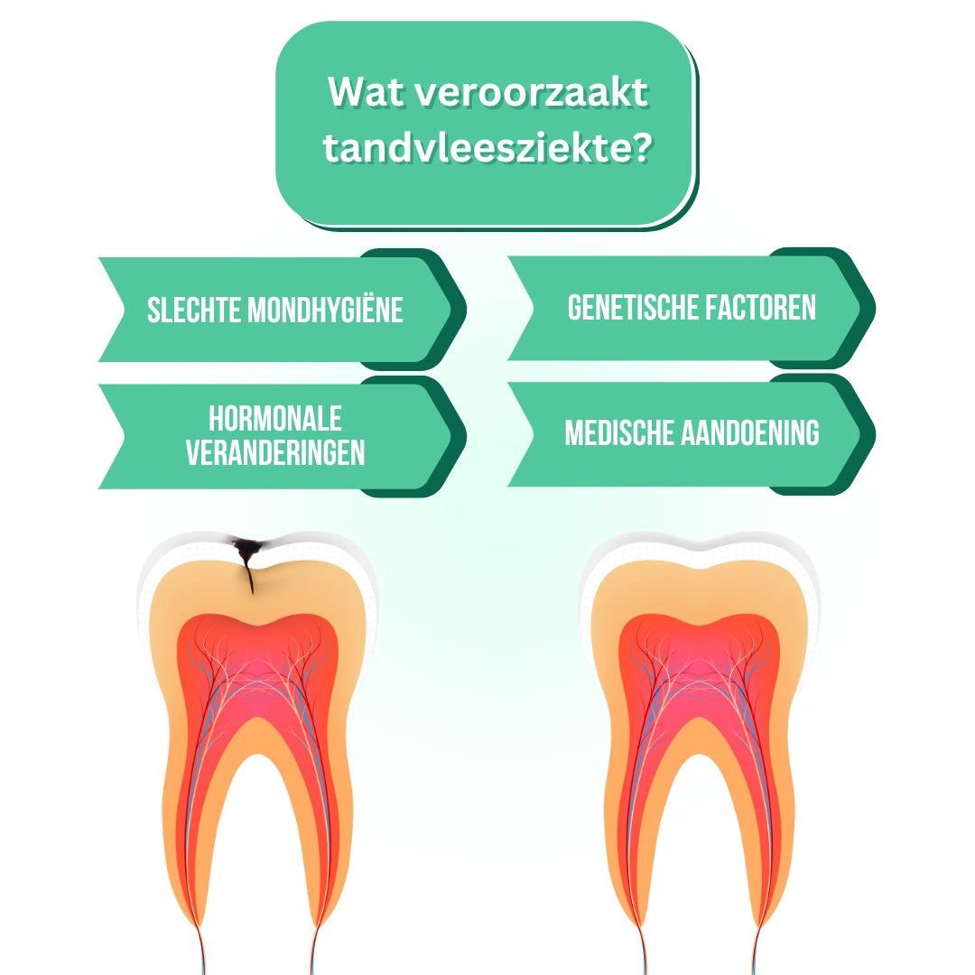 GumHeal® | Gezonder tandvlees in 2 weken!